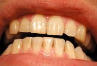 teeth 